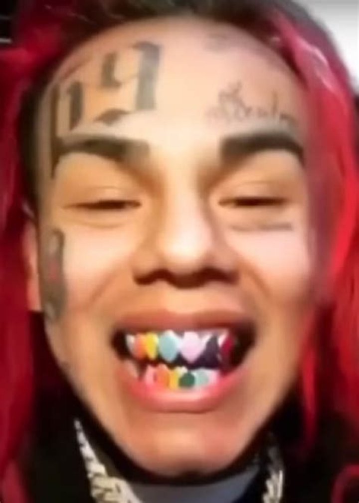 6ix9ine showing his teeth while speaking about his past in 2018