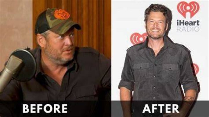 Blake Shelton weight loss