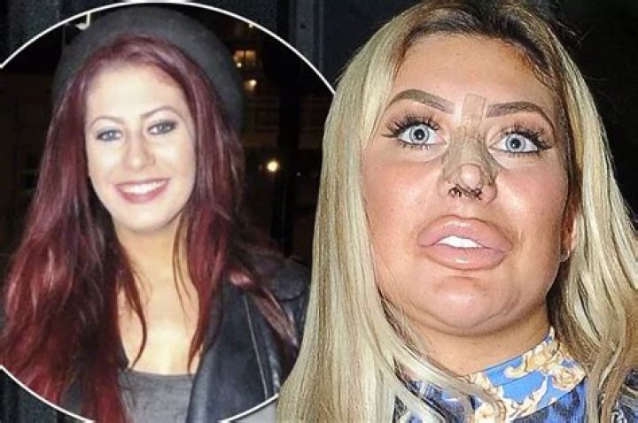 Chloe Ferry before and after weight loss