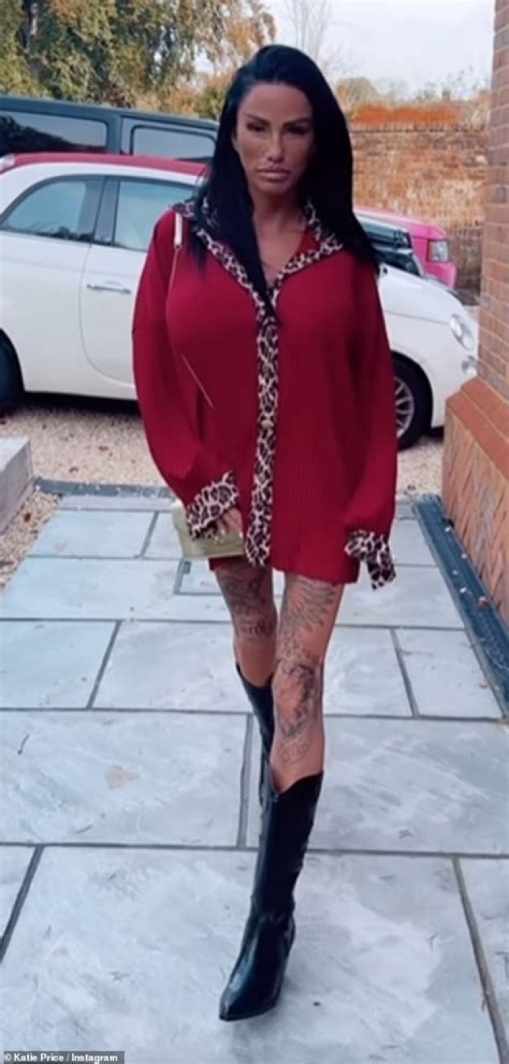 Katie Price legs