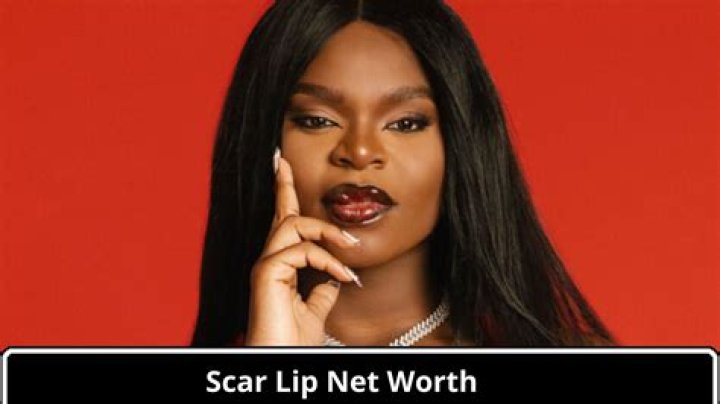Scar Lip as seen in an Instagram post in December 2023