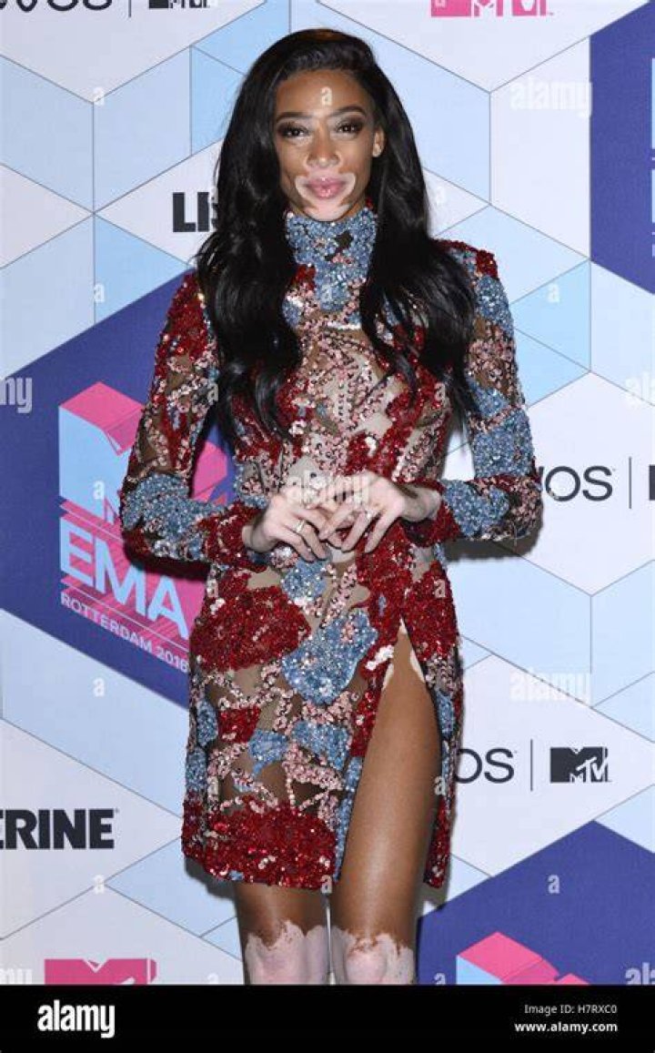 Winnie Harlow at MTV Europe Music Awards 2016